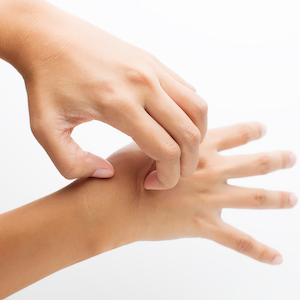 Eczéma et dermatite atopique