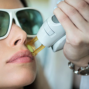 Lasers épilatoires - Eliminer les poils à long terme